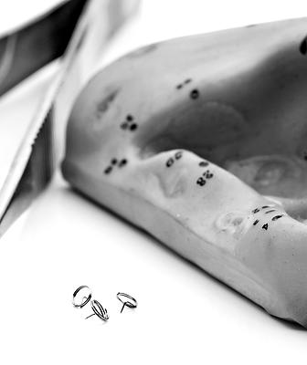 acupuncture points for ear stapling in cordova tn